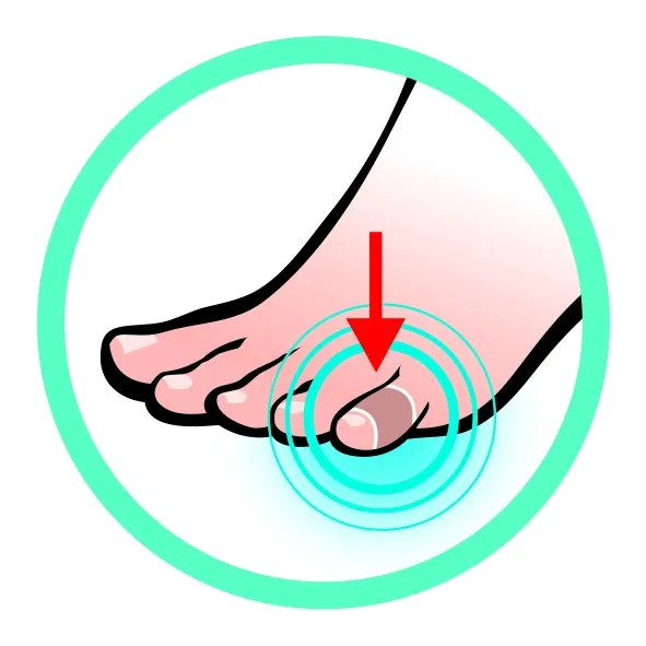 Illustrazione del piede in cerchio con focus sulla punta, la freccia rossa indica il punto di pressione.