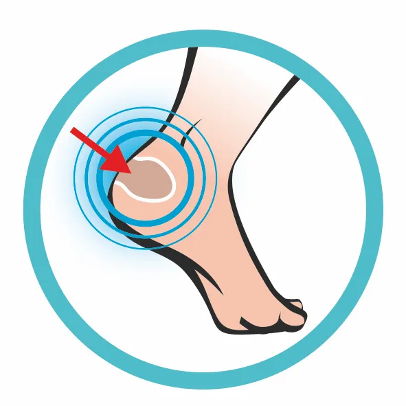 Illustration d'un pied sur lequel une flèche rouge pointe vers le talon, entourée de cercles bleus. Protecteur de pied.